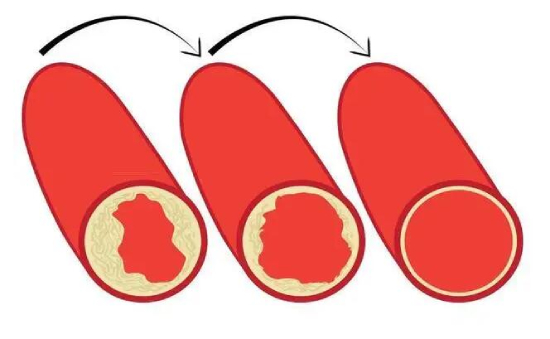 科悅：血管硬化的“照妖鏡”——?jiǎng)用}硬化檢測(cè)儀