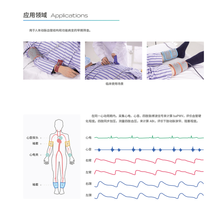 動(dòng)脈硬化檢測(cè)儀應(yīng)用領(lǐng)域